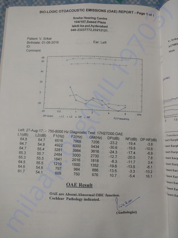 Hearing Assessment Report - Left Ear