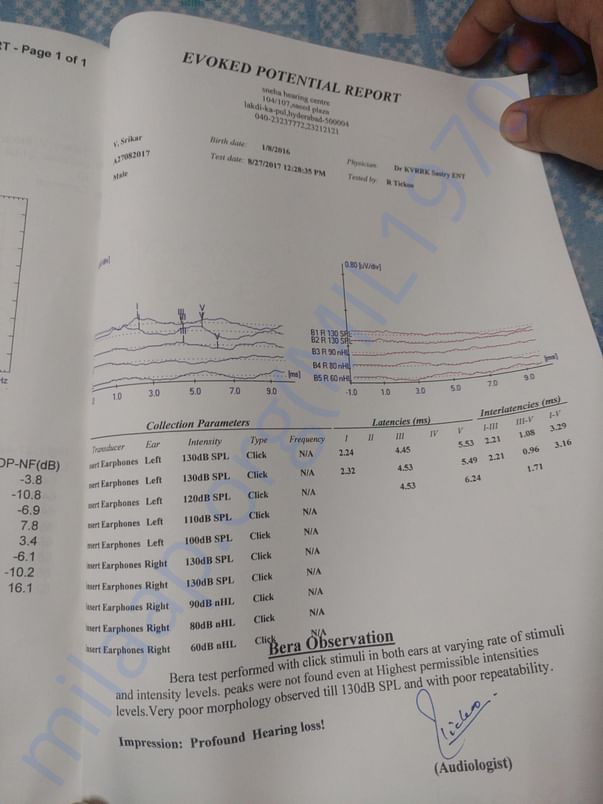 Hearing Assessment Report - Bera Observation