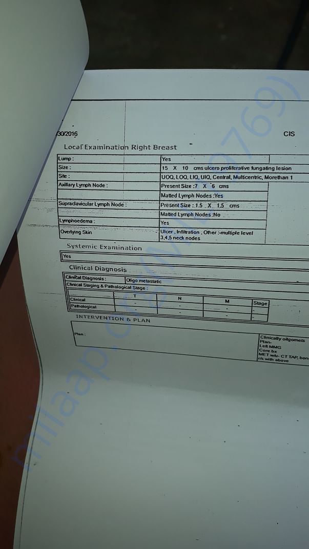 report about ulcer on right breast from tata hospital