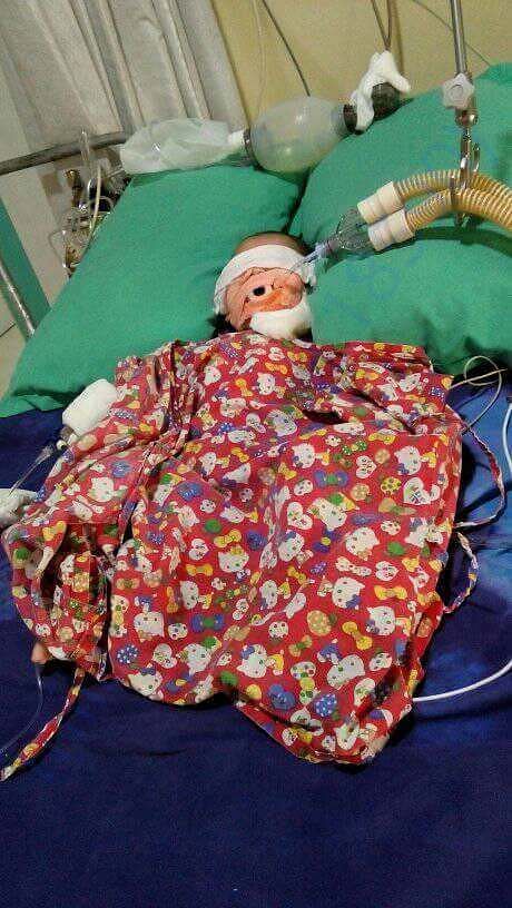 PICU ,PRATIKSHA HOSPITAL,GUWAHATI