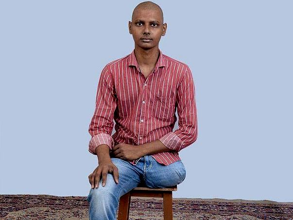 Help Fund For My Cancer Treatment And Buy A Prosthetic Leg