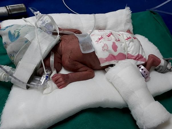 HELP FOR SAVE MY BABY GIRL