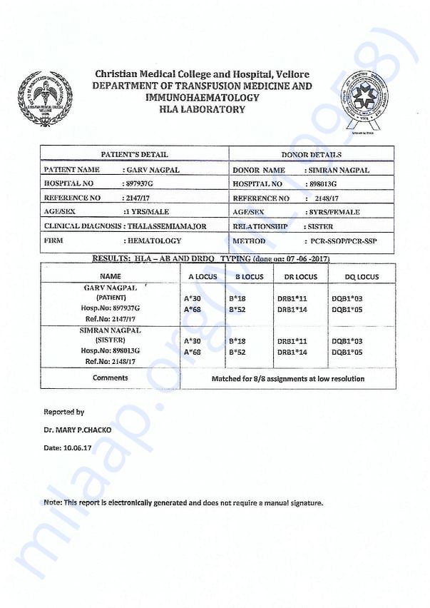 HLA REPORT OF GARV NAGPAL