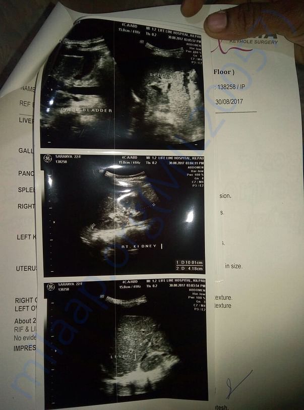 Scan 3