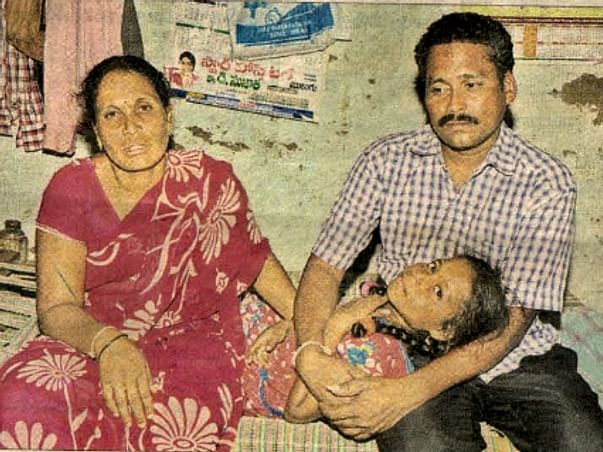 Please help 13 year old Jahnavi, she needs kidney transplantation