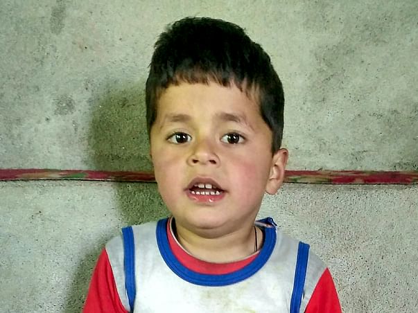 Help Uzair Javid To Undergo Treatment