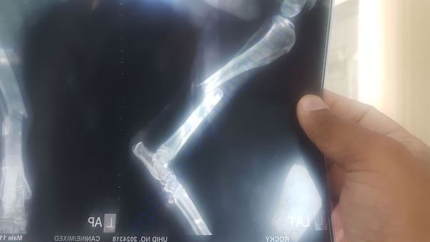 X-ray showing breakage