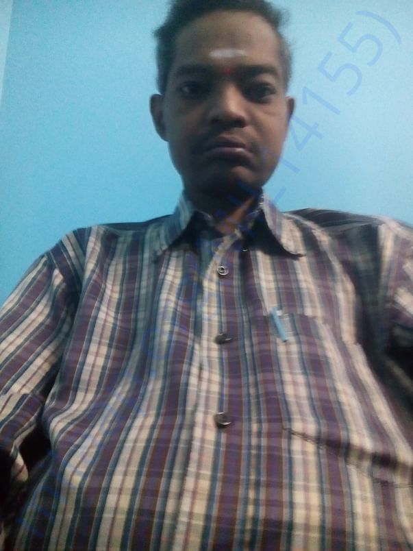 Latest photo.1 - after removing ascetic fluids