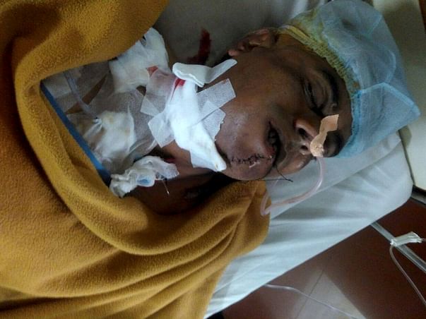 Help My Uncle Ashwinbhai fight Against Mouth Cancer