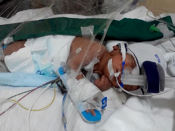 Help Punit's Pre-Term Baby