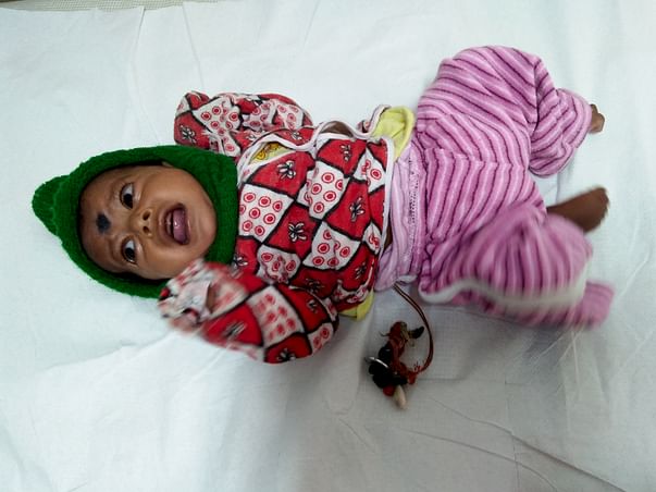 Help Baby Rinku Undergo A Heart Surgery