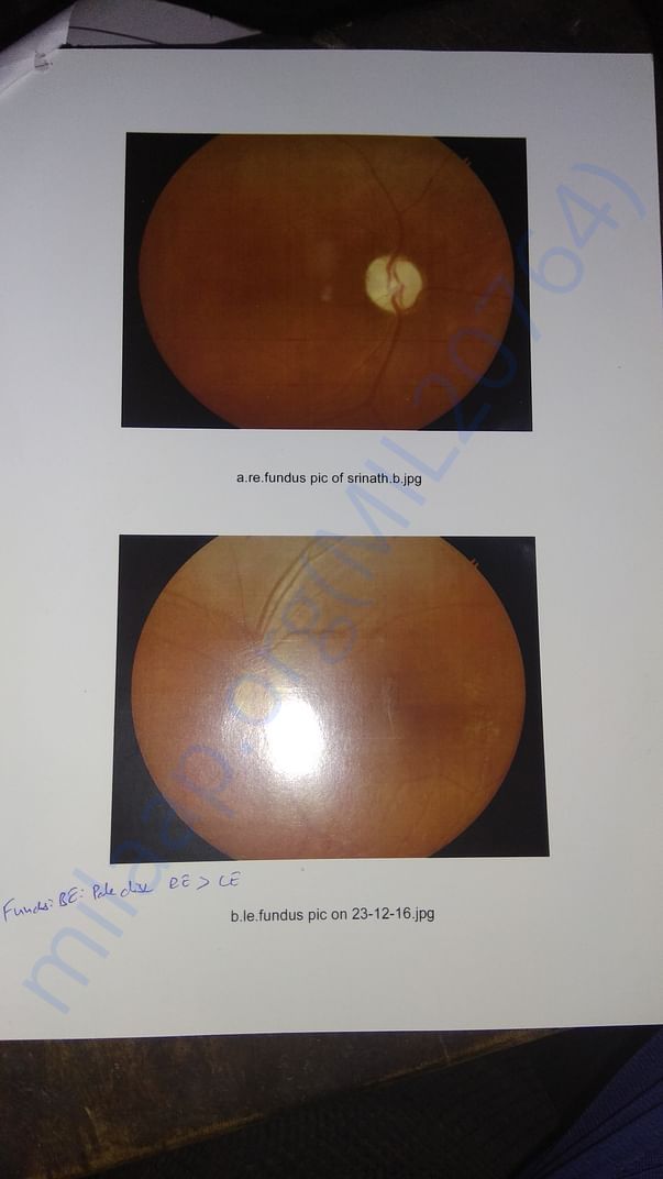 Eye report