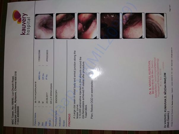 Endoscopy