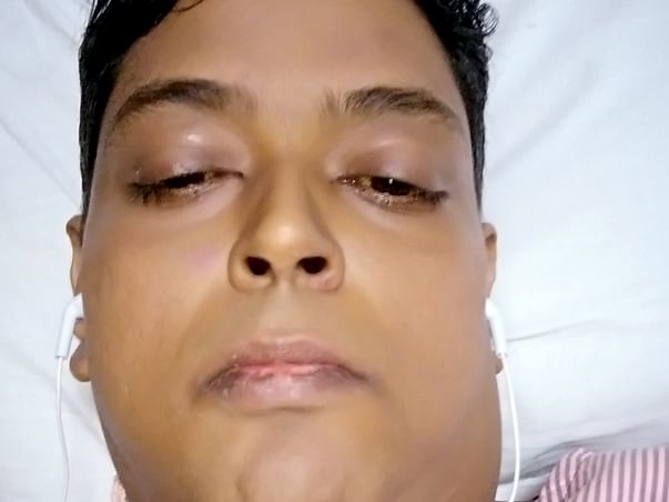 Help mandip get a new liver and a new life