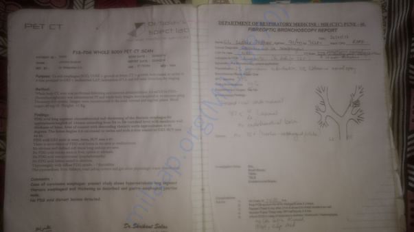 Treatment File
