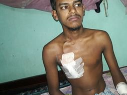 Help Abdur for Kidney Transplant