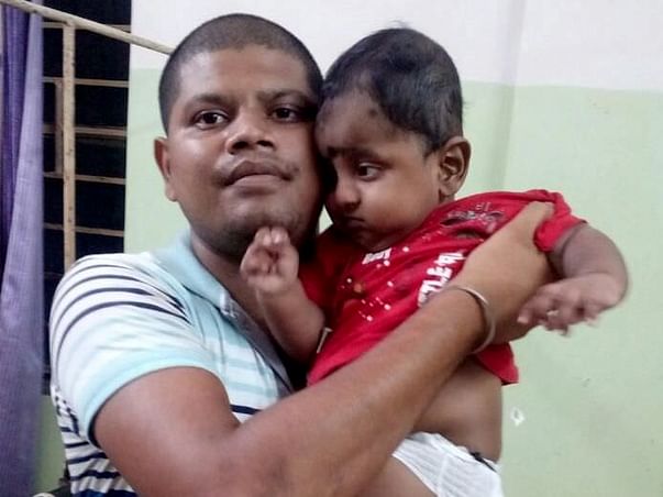 Help 5-month-old Aditya recover from swelling of the head