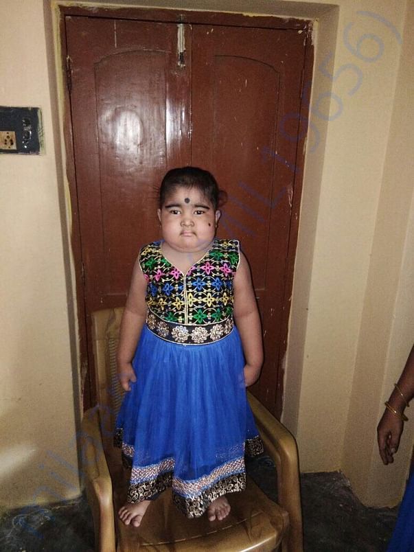 Recent pic of the baby Gayatri.. Sugrey needs to be done @ the earlies