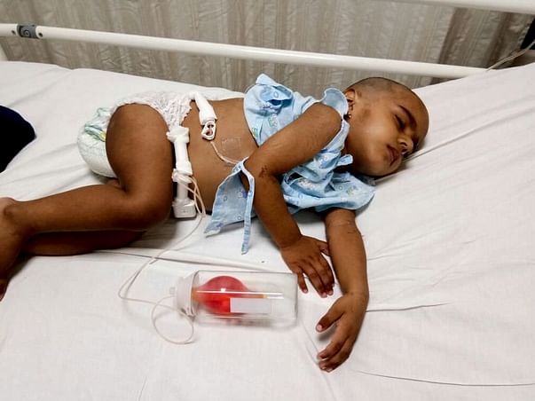2-year-old Aniketh urgently needs your help to fight Liver Cancer