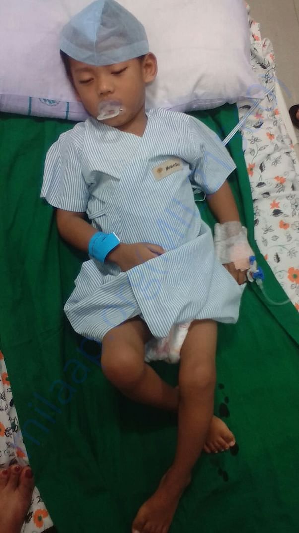 After stem cell therapy