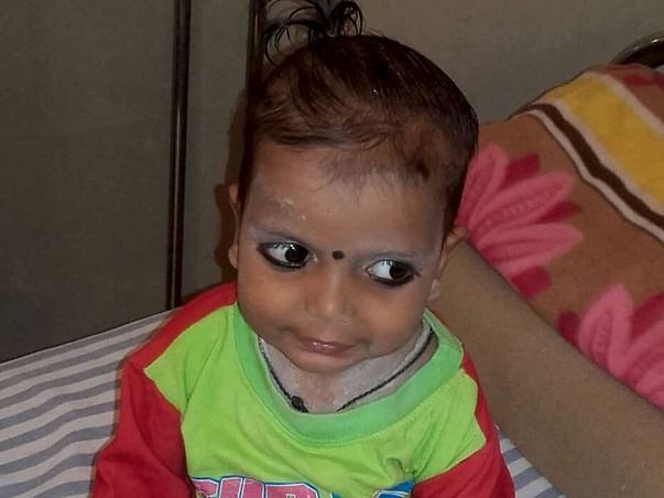 Help 2-Year-Old Viraj Fight Against Blood Cancer