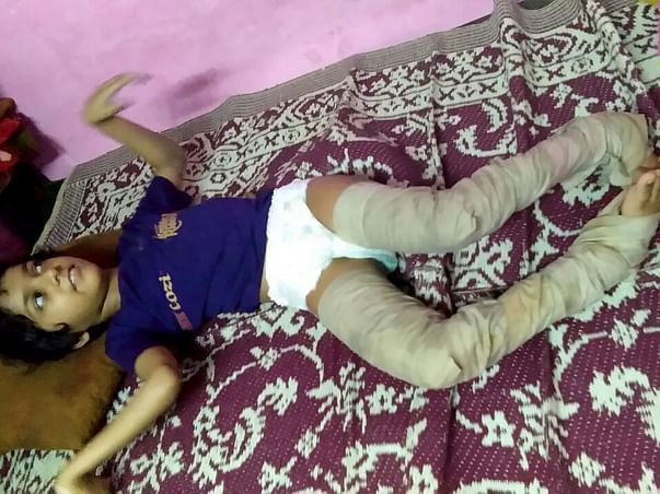 Help Ashifa To Overcome Her Physical Challenges