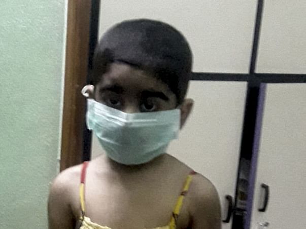 Post bmt treatment plz help