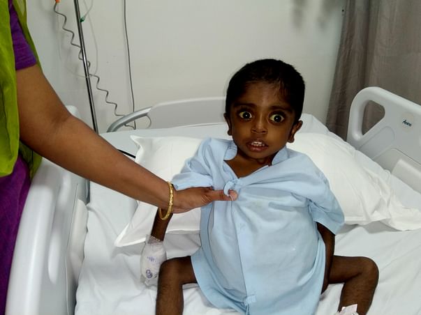 Help 2-year-old Sriesha fight end stage liver failure