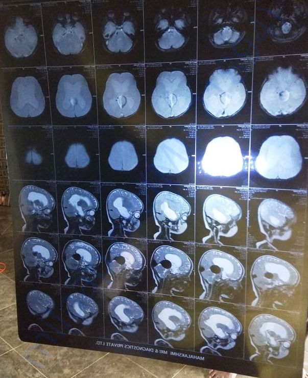 SCAN Report
