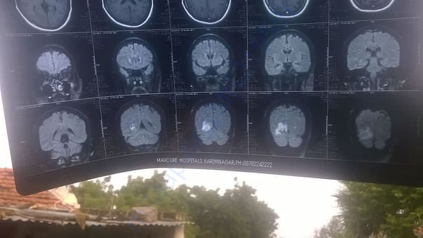 MRI scan