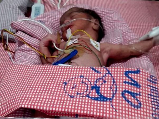 Help to Save the life of 3 weeks old premature born twins