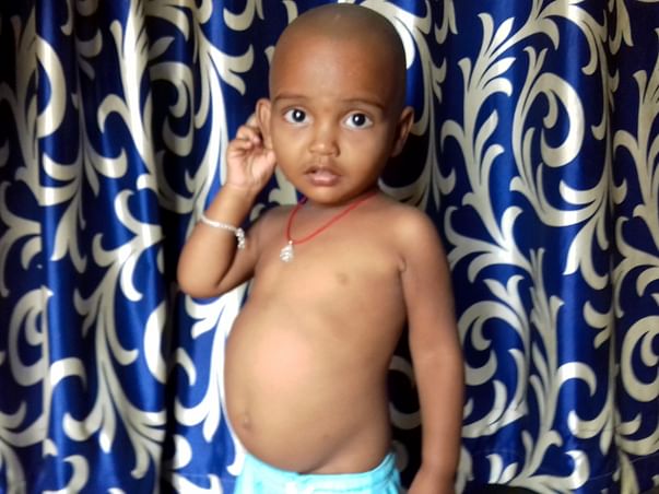 Help 2-year-old Akhilesh undergo a liver transplant