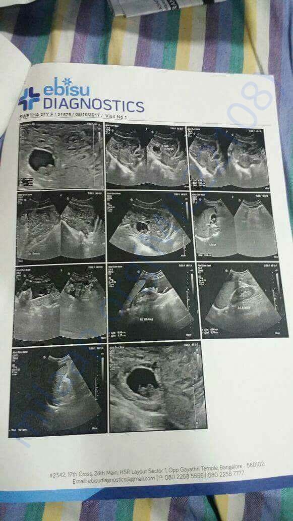 Ultrasound report