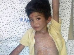 Help This 5-year-old With A Liver Abscess Who Is Screaming In Pain