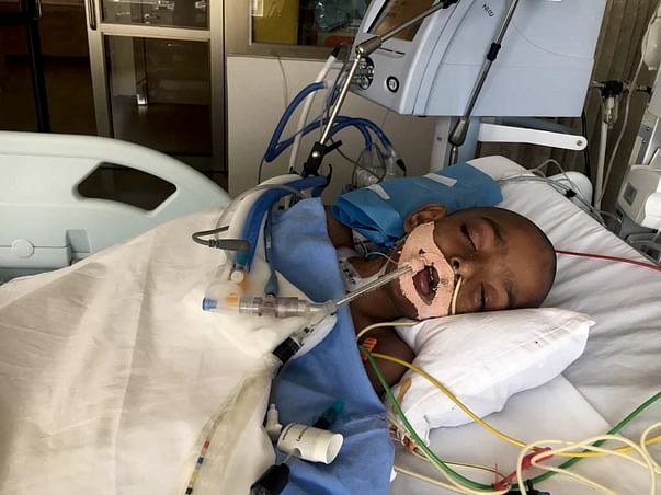 Help 4-year-old Neenu on life support fight severe Pneumonia
