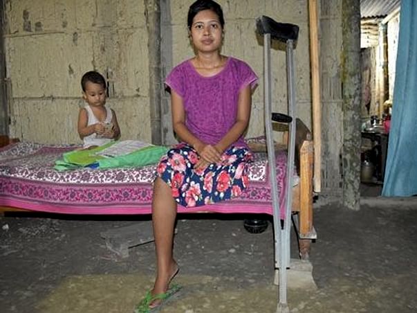 Help Jutika To Get Her Leg Back