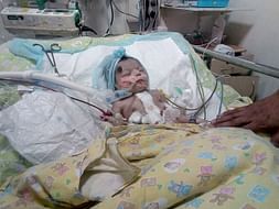 7-day-old Baby Is Braving A Heart Disorder. He Needs An Urgent Surgery