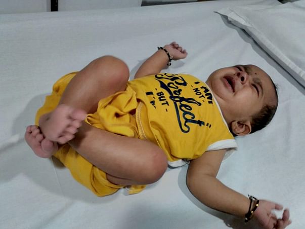 5-month-old Ridhan with a severe heart disease needs a heart surgery