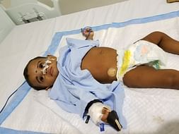 1-year-old Vyga with a swollen stomach urgently needs help