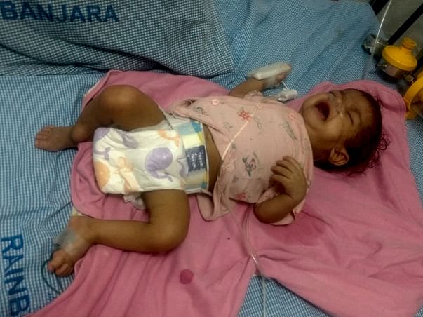 Help 11-month baby Jai battle tuberculosis