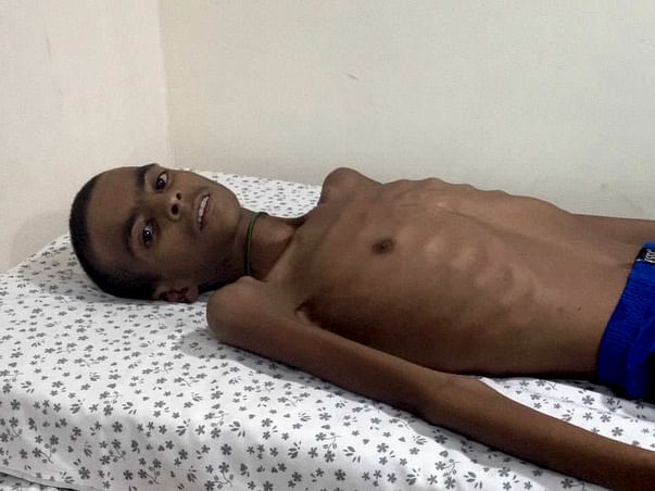 Help 16-year-old Shabaz recover from severe malnutrition