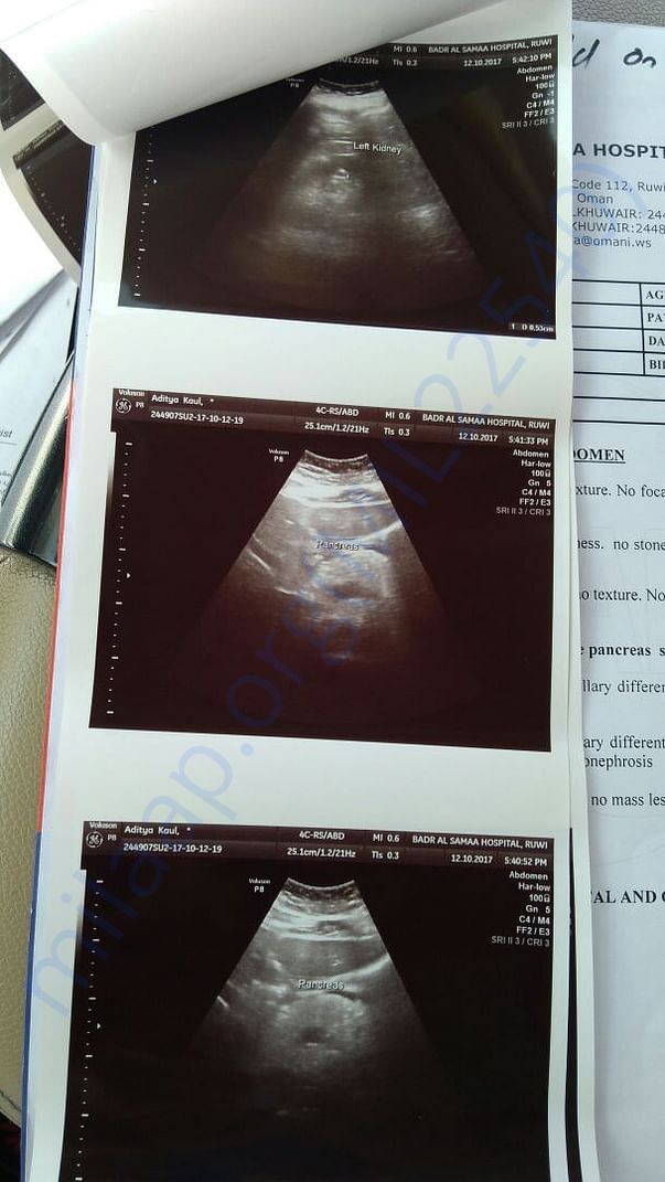 Scan 1