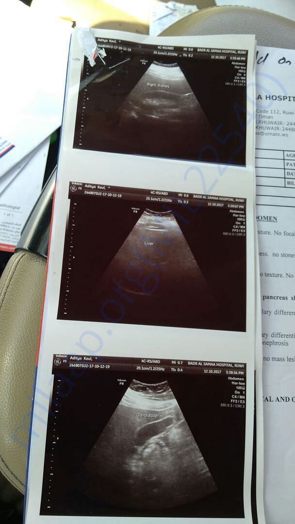 Scan 5
