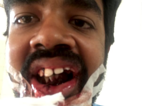 Help Vishnu To Put Smiles Back On Thousands Of Farmers And Kids