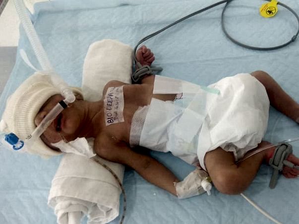Manoj's 14-Day-Old Son Needs Your Support To Live