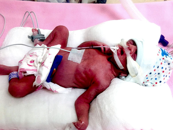 Help Save My Baby Girl