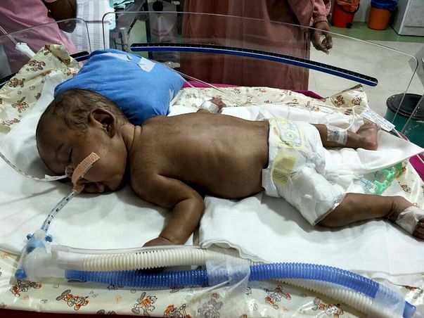 Help Baby of Karthika to See World After an Year of Struggle