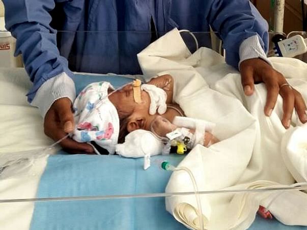 Help Bhagya's baby fight a severe stomach disease