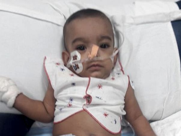 8-month-old Bhavya Is In Respiratory Distress And Needs Your Help