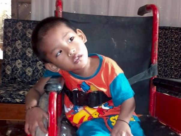 Plize help baby Alun .. As he needed stem cell therapy or bone marrow